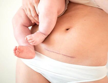 Postpartum Recovery: Be Kind to Your Body, Mama